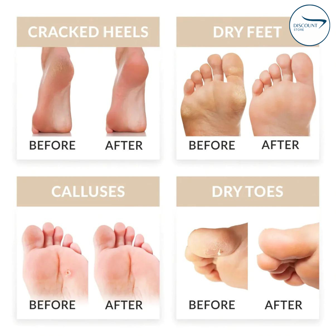 Portable Electric Pedicure Feet Callus Remover - Professional Foot Grinder